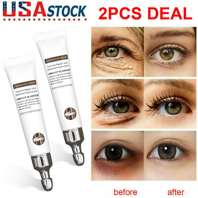#ad 2Pcs Magic Eye Cream 28 seconds to remove eye bags dark circles eye wrinkles $11.28
