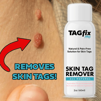 #ad Skin Tag Remover Skin Tag Removal Remove Skin Tags Fast Skin Tag Remover TAGFIX $19.99