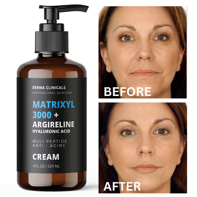 #ad #ad Matrixyl 3000 Argireline Hyaluronic Acid Peptide AntiAging serum Wrinkle CREAM $17.99