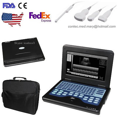 #ad Portable Laptop Machine Digital Ultrasound Scanner CMS600P2 Optional 4 Probe $1249.00