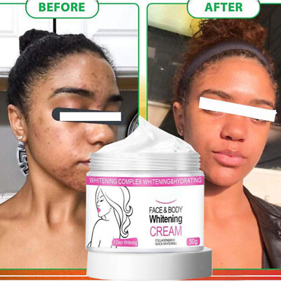 #ad Collagen Dark Skin Bleaching Cream Body Whitening Lightening Brightening Lotion $8.95
